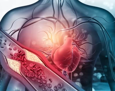 突然の心臓死に注意する: 見落とされている無声血管キラーの発表とビタミンK2が心臓を保護する方法